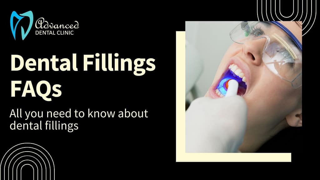 All you need to know about Indian Dental Fillings: FAQs
