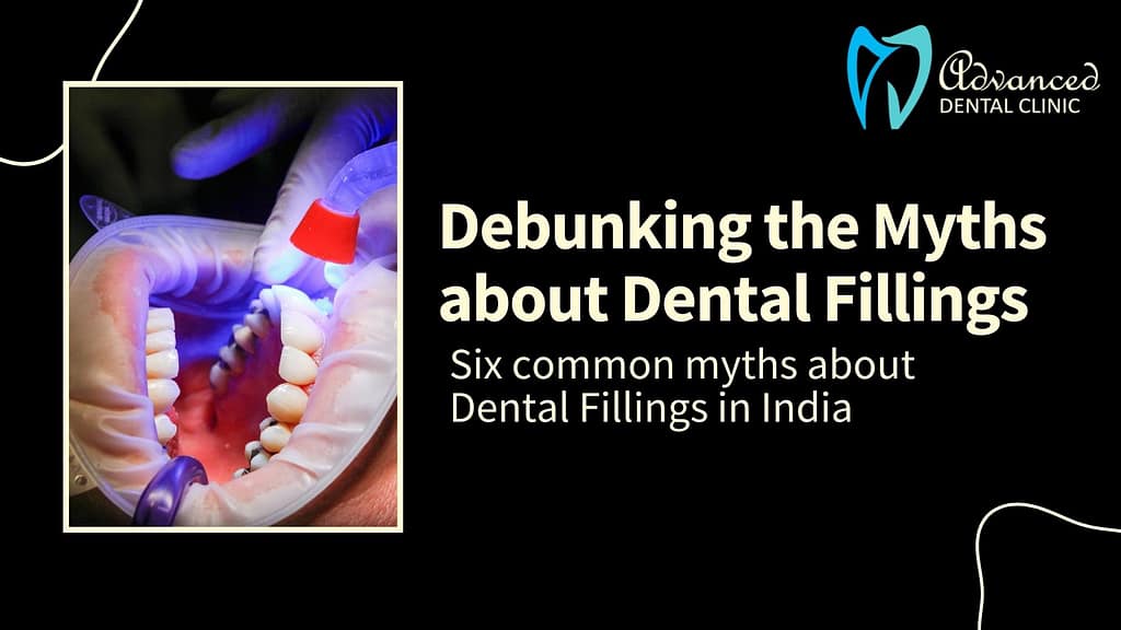Debunking the Myths about Dental Fillings