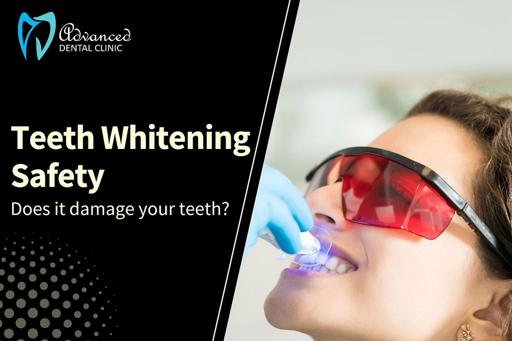 Does teeth whitening damage your teeth