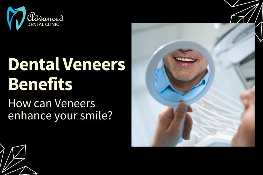 Top 7 Major Benefits of Dental Veneers in Smile Transformation