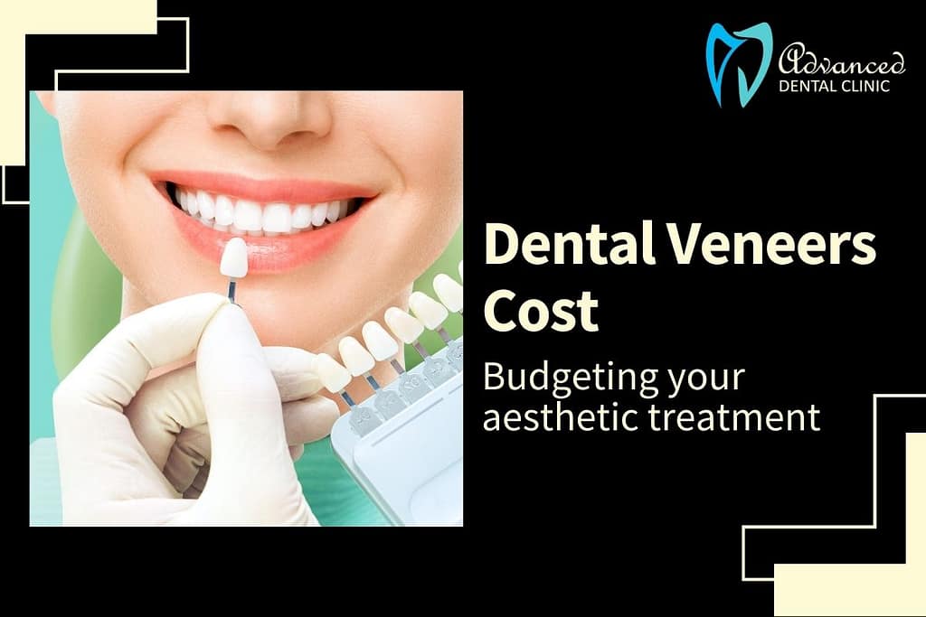 Plan your Budget for Dental Veneers: Dental Veneers Cost