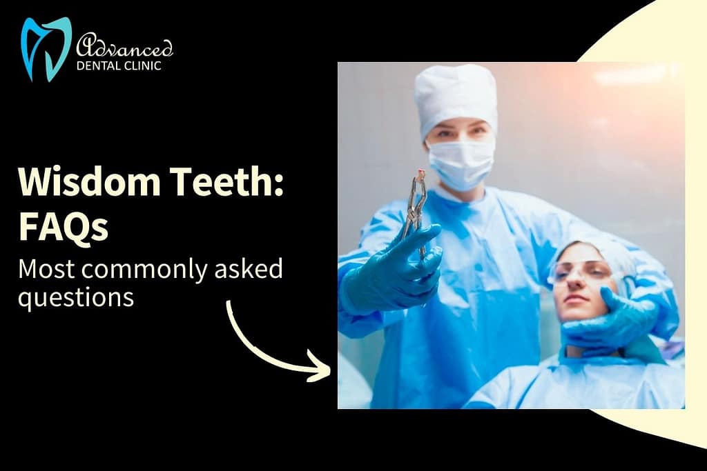 Wisdom Tooth: Frequently Asked Questions