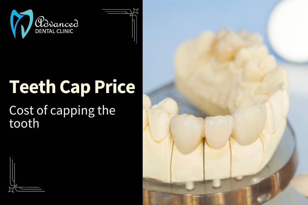 The cost to protect the teeth