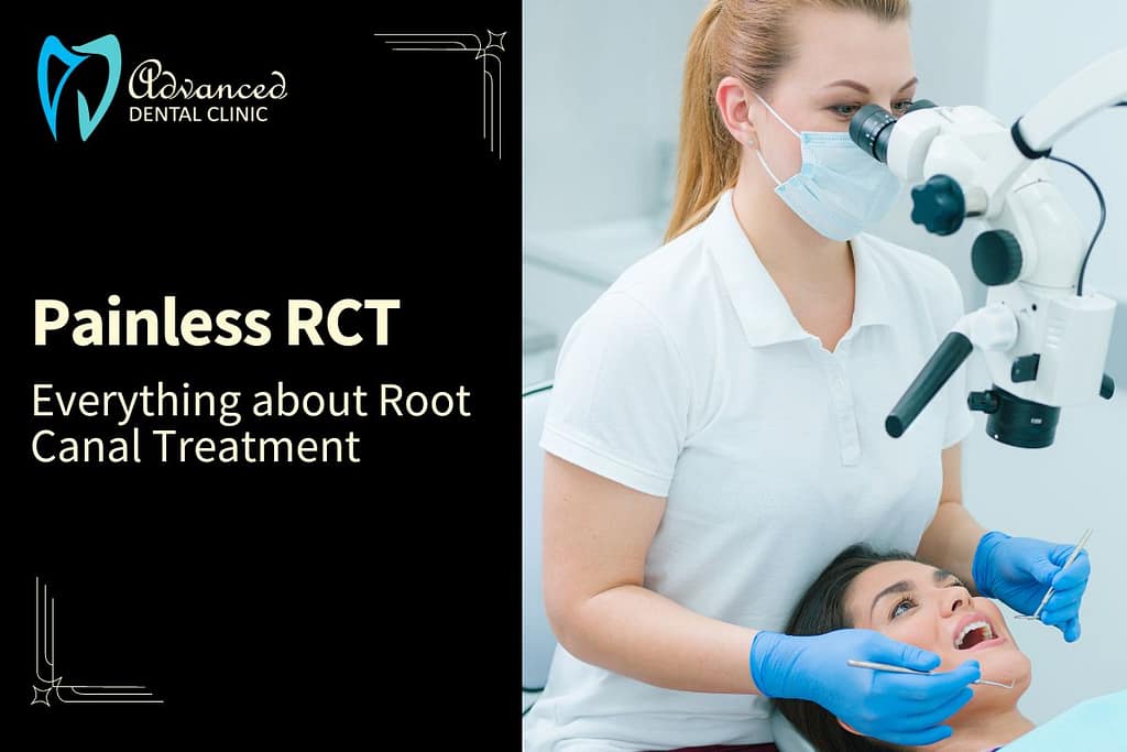 All about RCT – Painless Root Canal Treatment
