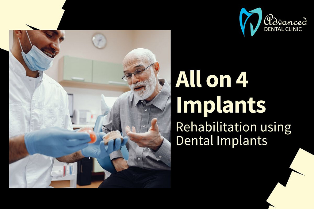 All on 4 Implants Full Mouth Rehabilitation