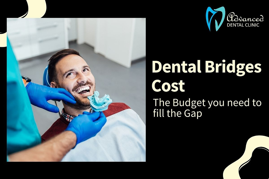 Budget you need to replace missing teeth