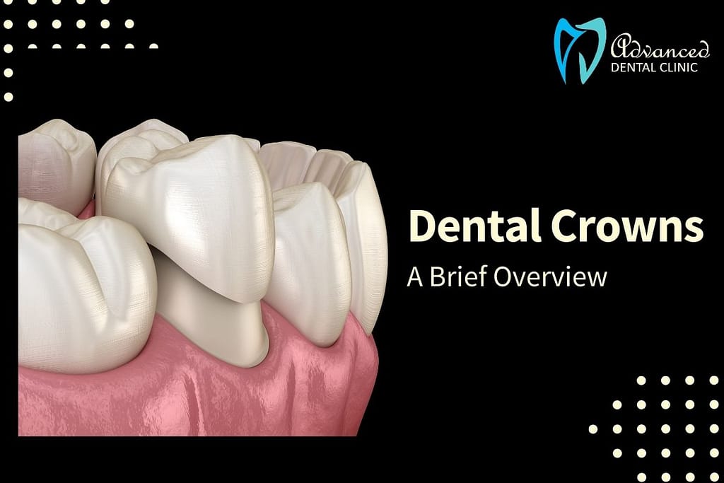 Dental Crown Treatment – A Brief Overview