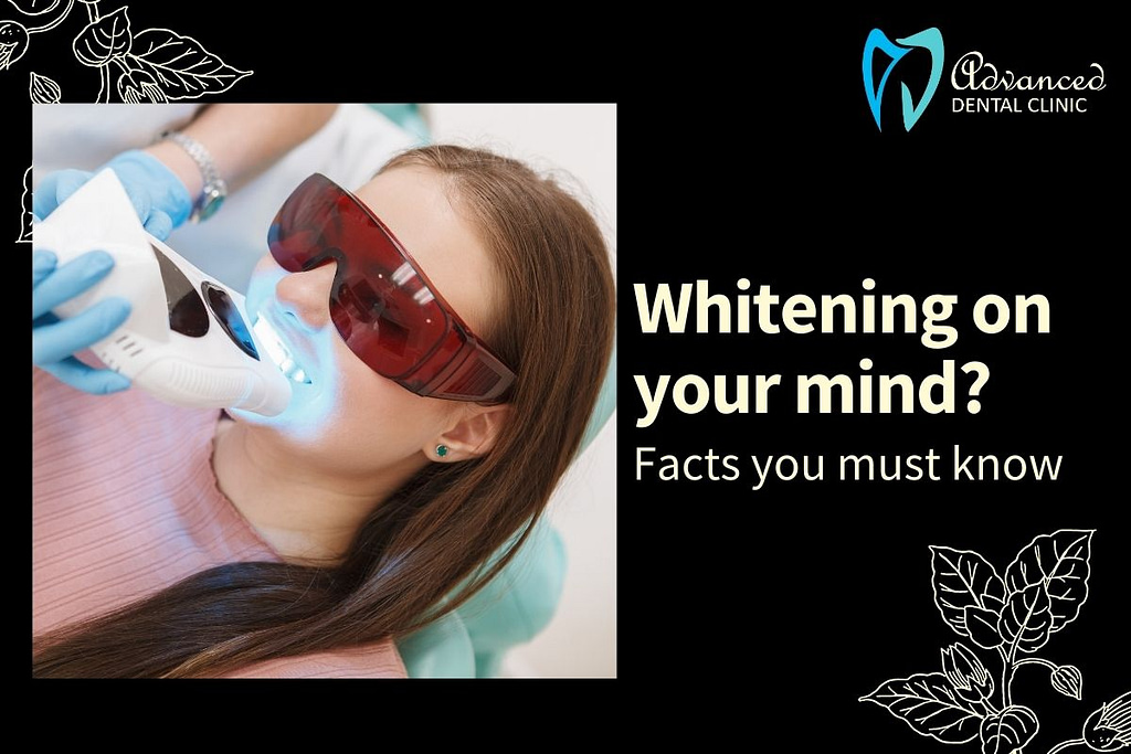 Teeth Whitening FAQ
