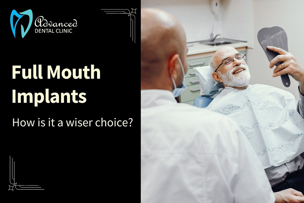All you need to know about Full Mouth Implants