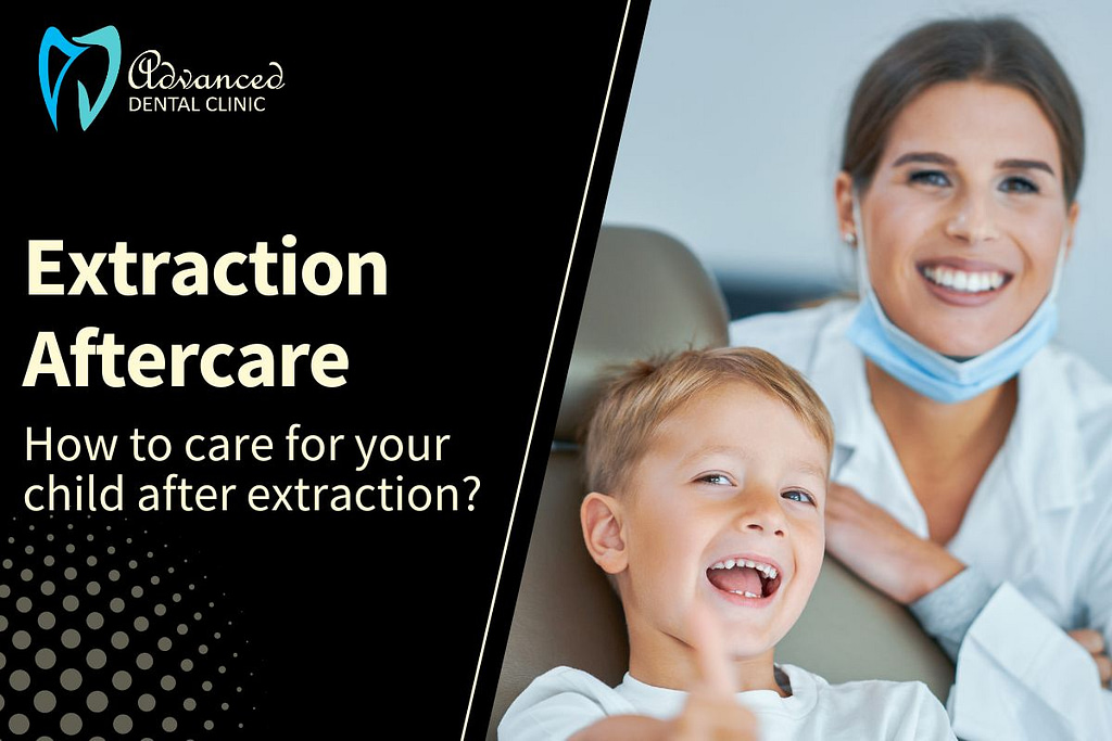 Points to remember – Kids Teeth Extraction Aftercare