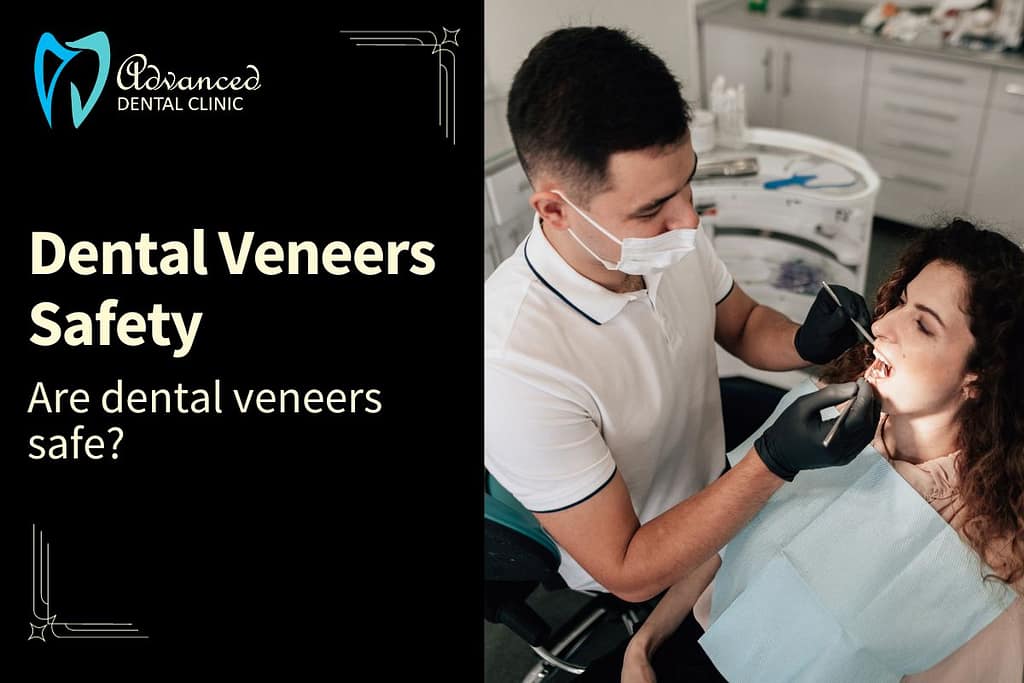 Are dental veneers safe – Let’s find out