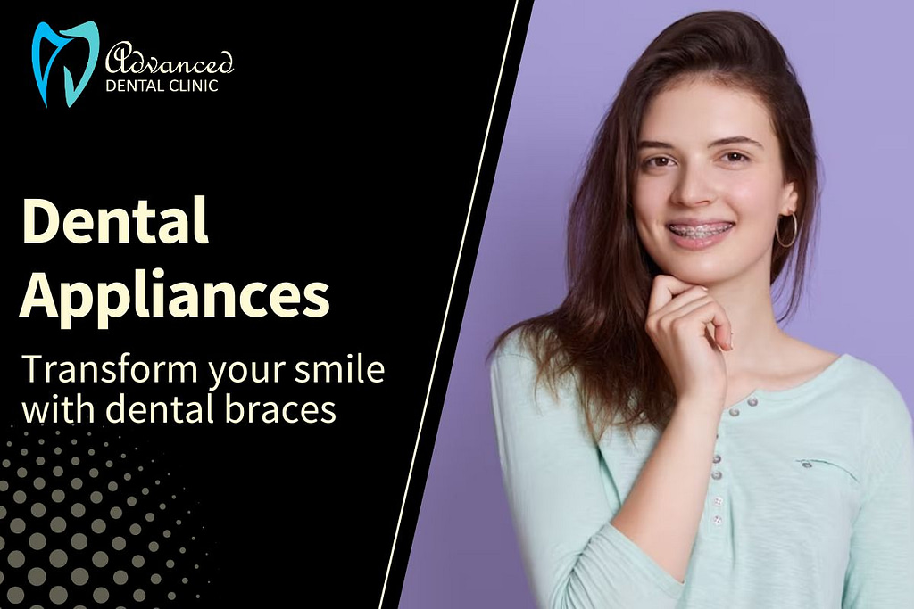 Dental Appliances – Transforming Smiles with braces