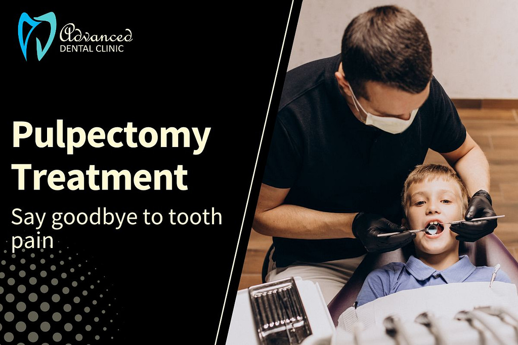 Say goodbye to tooth pain – Pulpectomy Treatment Delhi