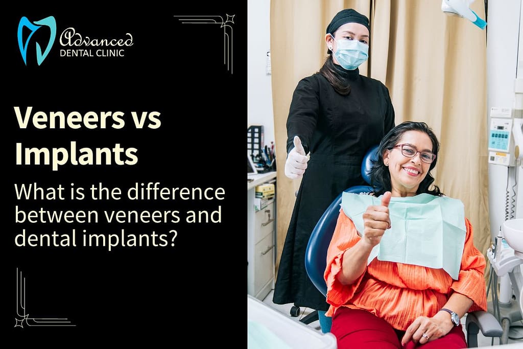 What is the difference between Veneers and Dental implants?