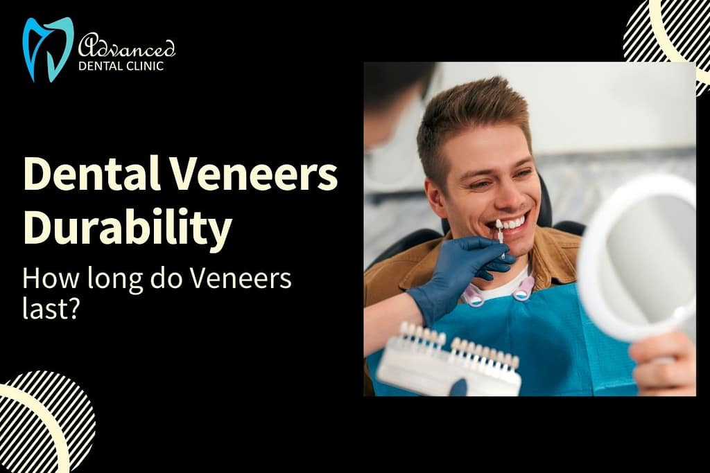 Top Factors affecting the Longevity of Dental Veneers