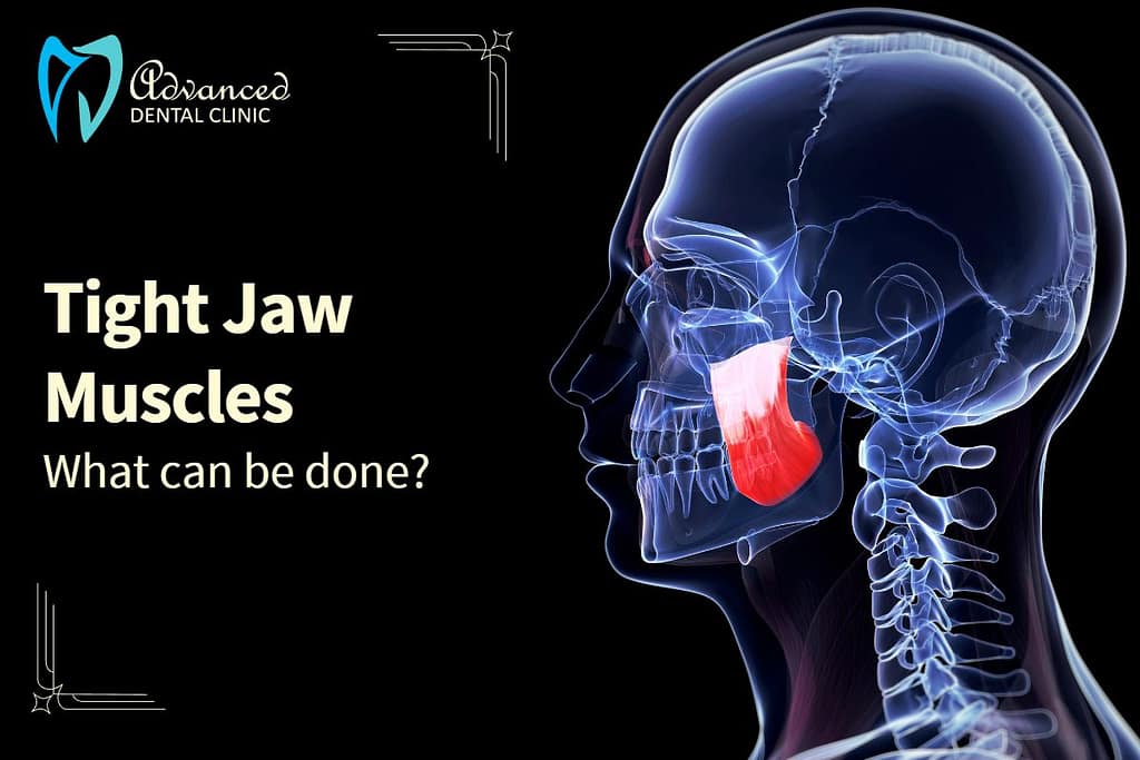What can be done for Tight jaw muscles?