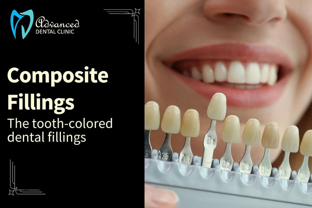 Composite Fillings in Adults – What you need to Know