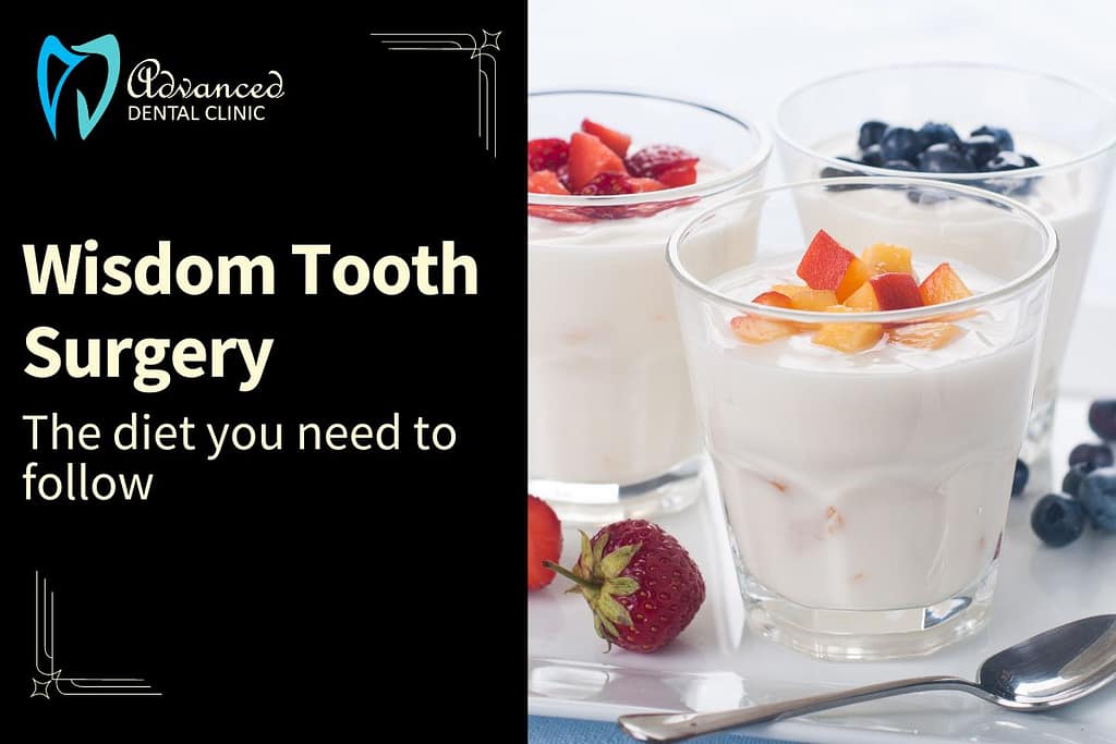 Nutrition for a Speedy Recovery – Diet After Wisdom Tooth Surgery