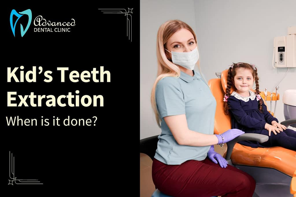 Whys and How of Kids Teeth Extraction in Delhi