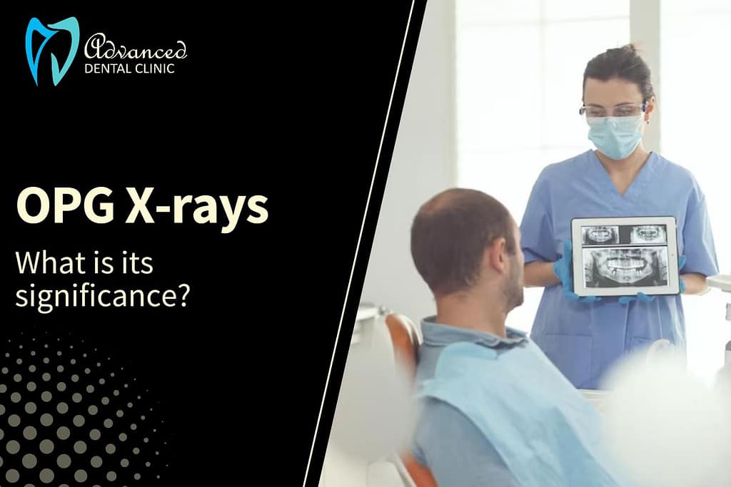 OPG X Rays in Delhi and Braces Treatment
