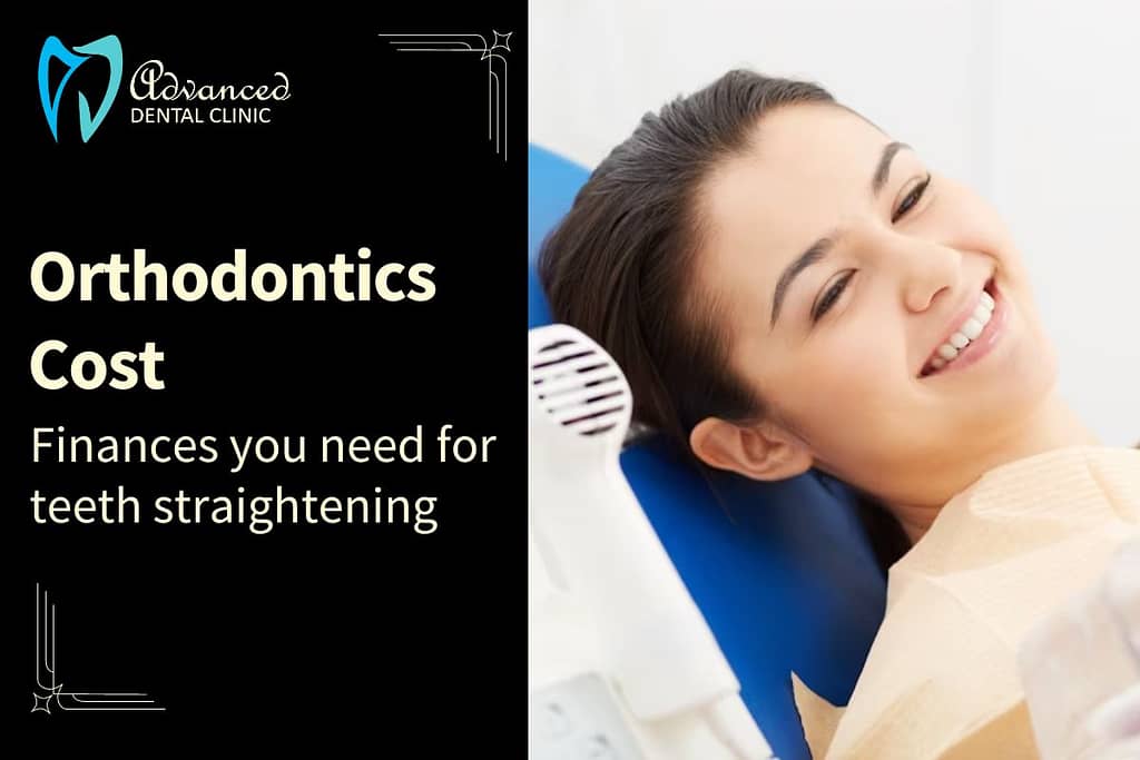 Finances you need for teeth straightening – Orthodontics Cost Delhi