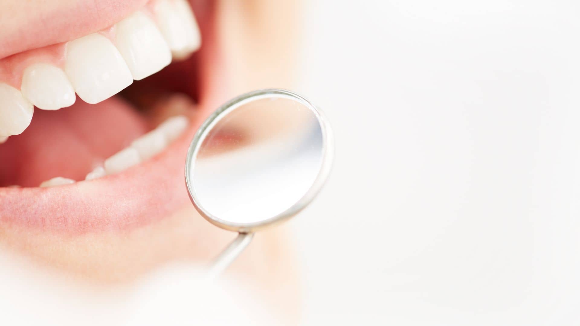 Teeth Reshaping in India