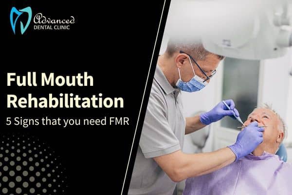 Five Signs That You Need Full-Mouth Rehabilitation