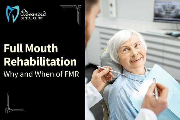 Full Mouth Rehabilitation or Restoration – Why and When?