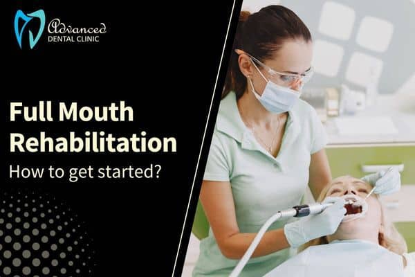 Getting Started with Full Mouth Rehabilitation