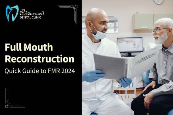 Quick Guide To Full-Mouth Reconstruction For 2024